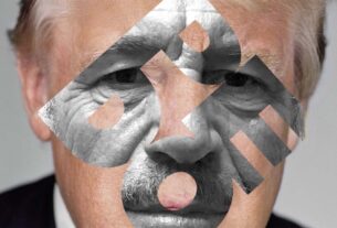 X-Ray-Stein | The Nation
